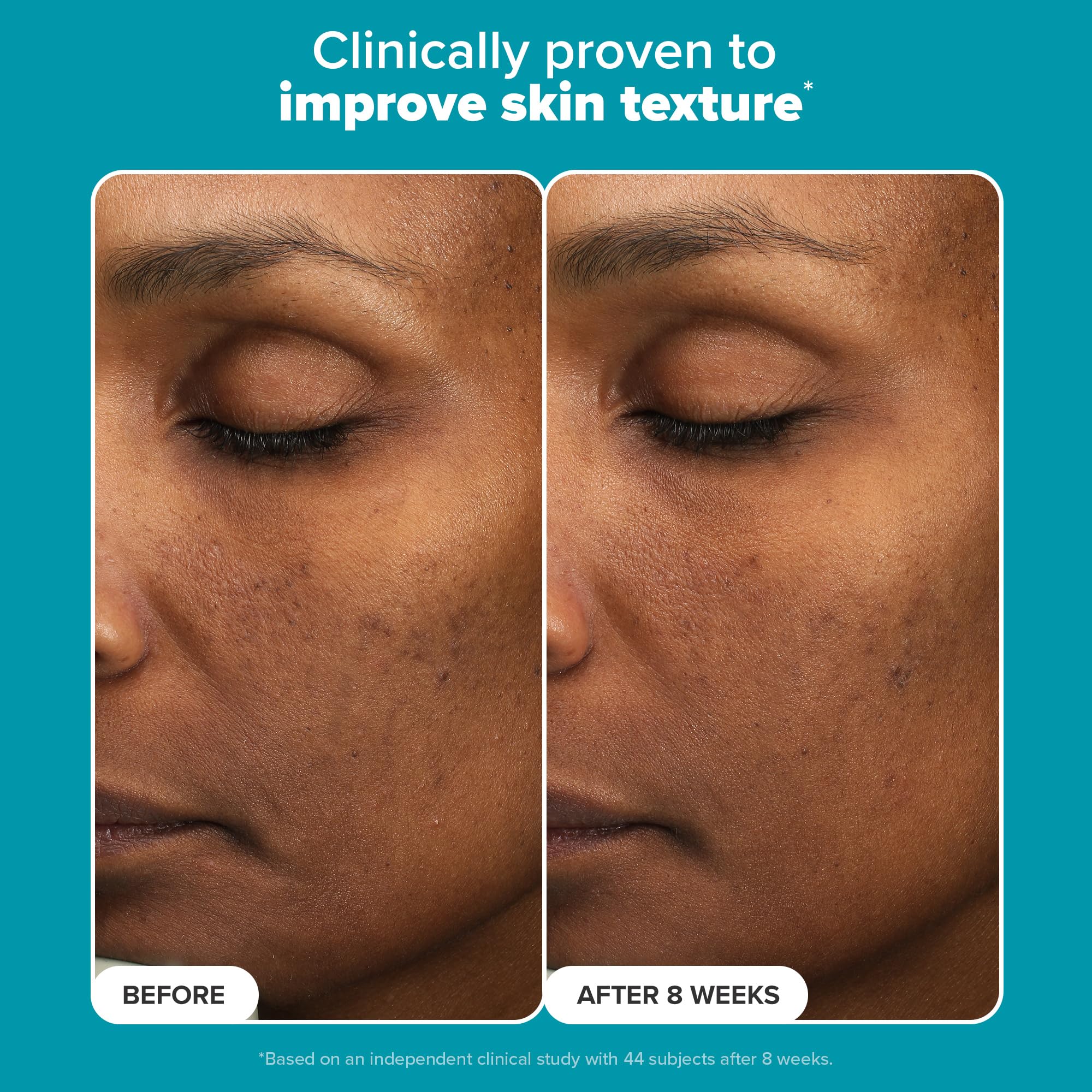 Foto 4 | Exfoliante Paula's Choice 6% De Ácido Mandélico Y 2% De Ácido Láctico - Venta Internacional.