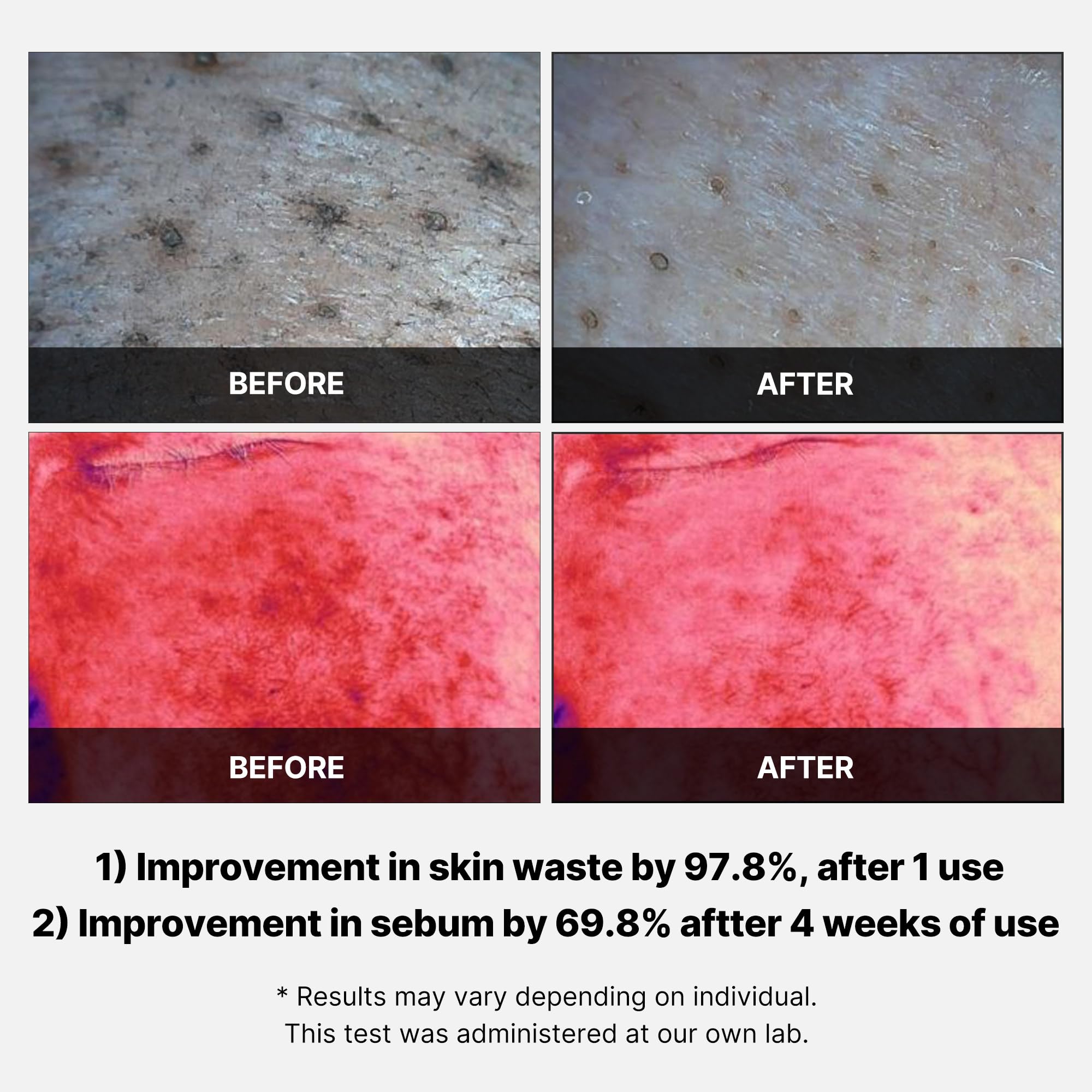 Foto 5 pulgar | Almohadillas Exfoliantes Faciales Medicube, Ácido Succínico Rojo Y Pantenol - Venta Internacional.