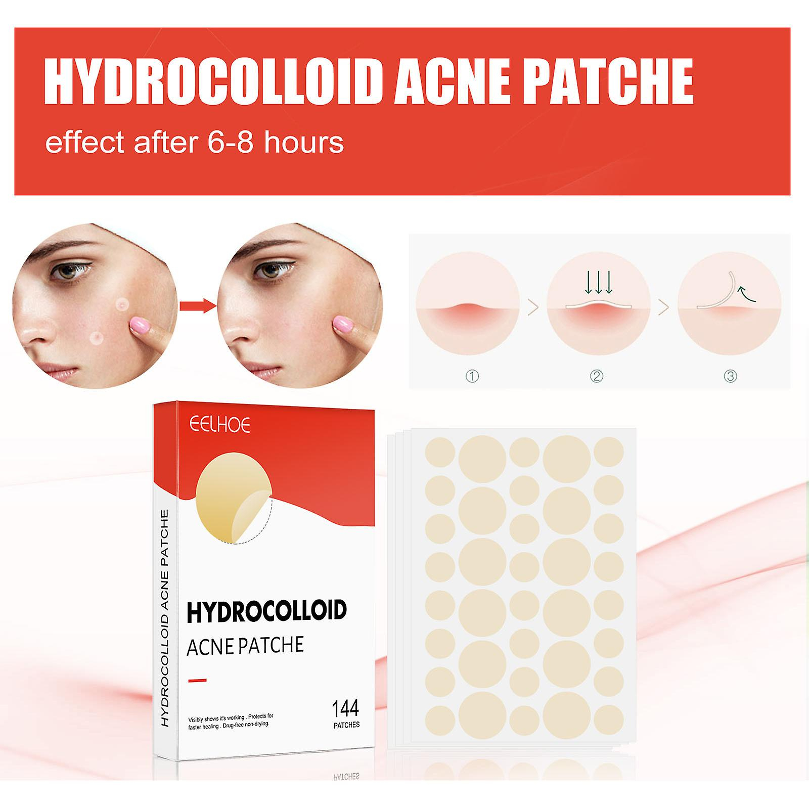 Foto 5 pulgar | Parche Hidrocoloide Para Acné Y Espinillas Huoguo Para El Tratamiento De Las Espinillas - Venta Internacional.