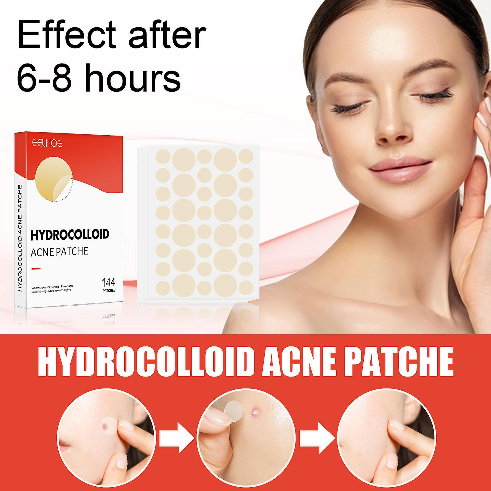 Foto 6 pulgar | Parche Hidrocoloide Para Acné Y Espinillas Huoguo Para El Tratamiento De Las Espinillas - Venta Internacional.