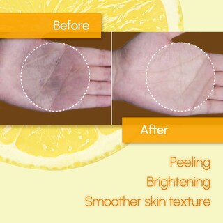 Foto 3 | Almohadillas Exfoliantes Dermalogy De Neogenlab Bio-peel Gauze Lemon 30 Almohadillas - Venta Internacional.