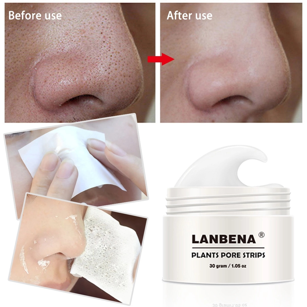 Foto 6 pulgar | Venta Internacional - Mascarilla Facial Lanbena Blanca, Removedor De Acné + 60 Tiras