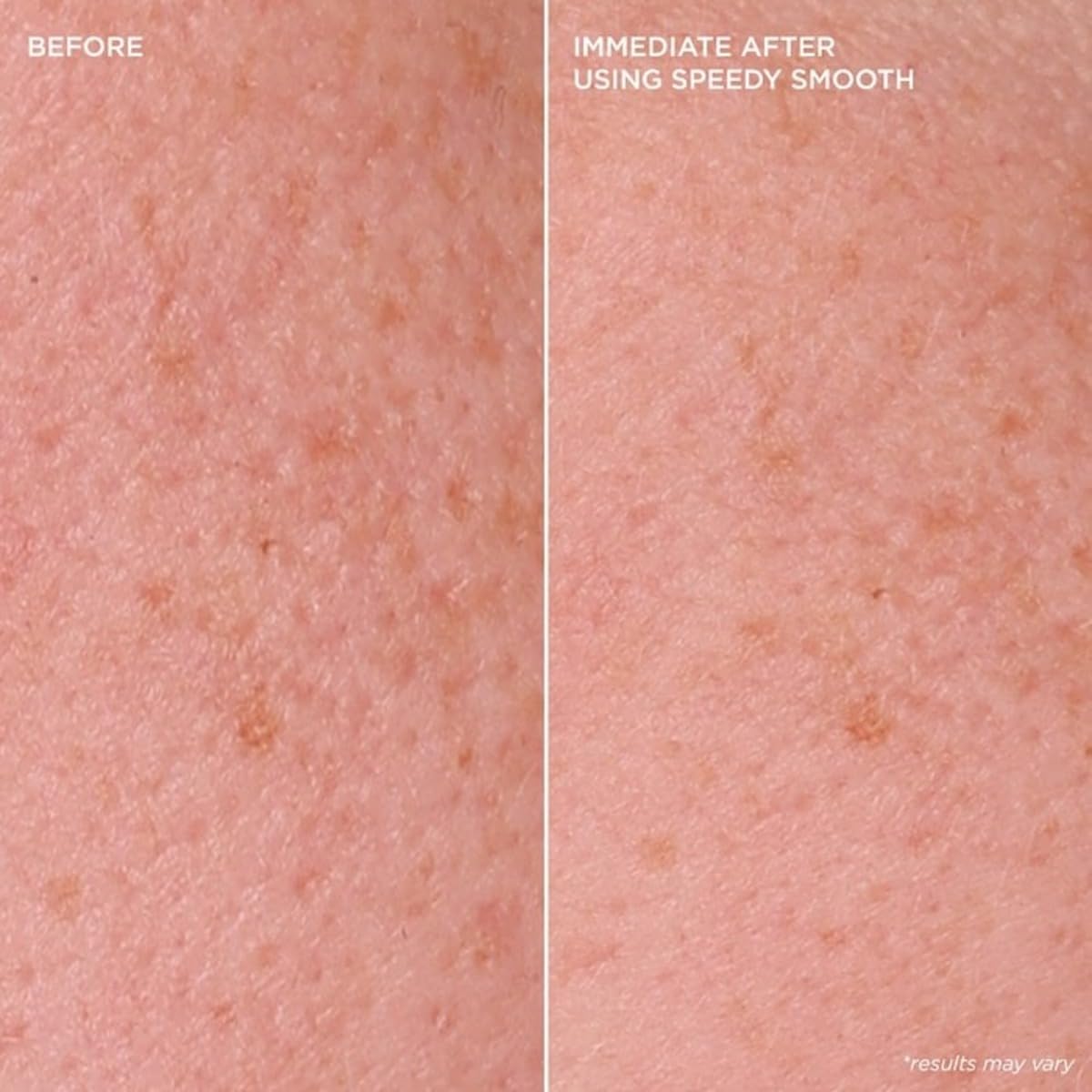 Foto 7 pulgar | Mascarilla Facial Benefit Speedy Smooth-Venta Internacional