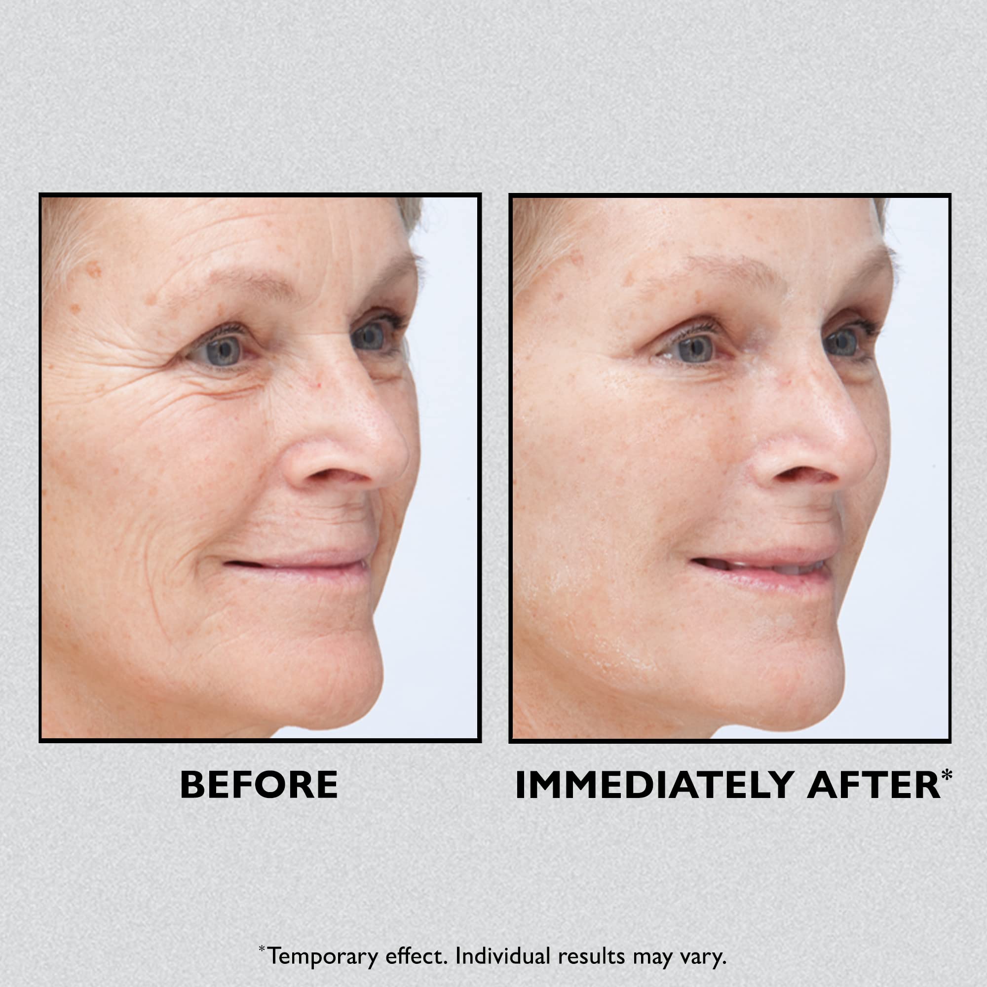 Foto 4 pulgar | Estirador Facial Peter Thomas Roth Instant Firmx Firm Lines - Venta Internacional.