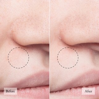 Foto 4 | La Filosofía De La Mascarilla Facial, La Pureza Hizo Que El Extractor De Poros Sea Simple - Venta Internacional.