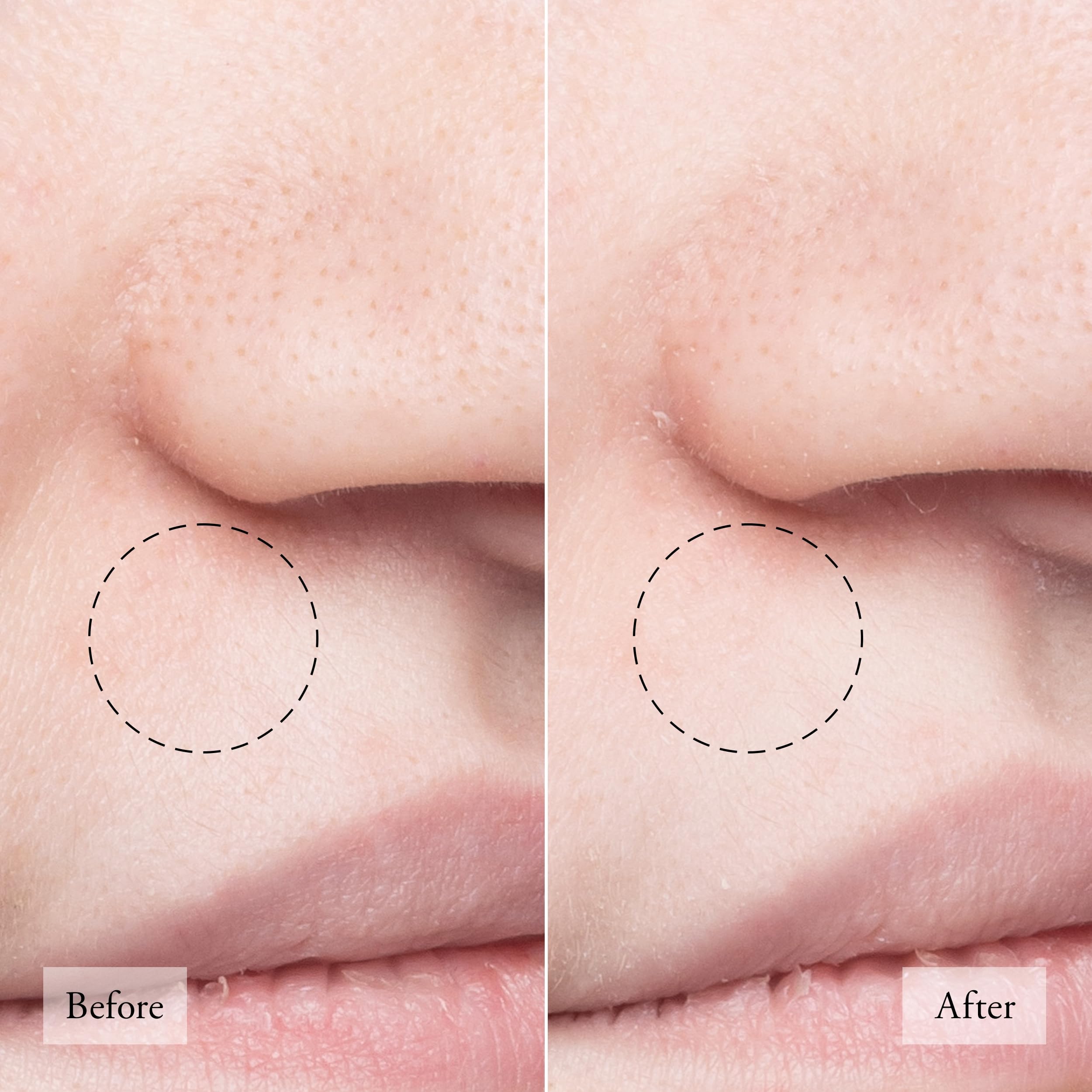 Foto 4 | Mascarilla Extractora De Poros: Filosofía: Pureza Hecha Simple, 30 Ml - Venta Internacional.