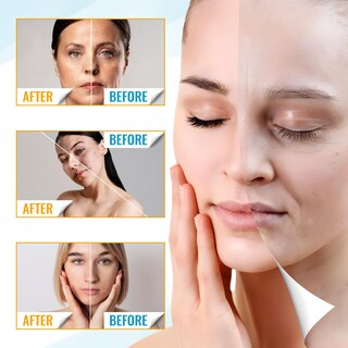 Foto 5 | Mascarilla Facial Peel Off Zombie, Reafirmante De Poros, 8 X 8 Ml, 2 Cajas - Venta Internacional.