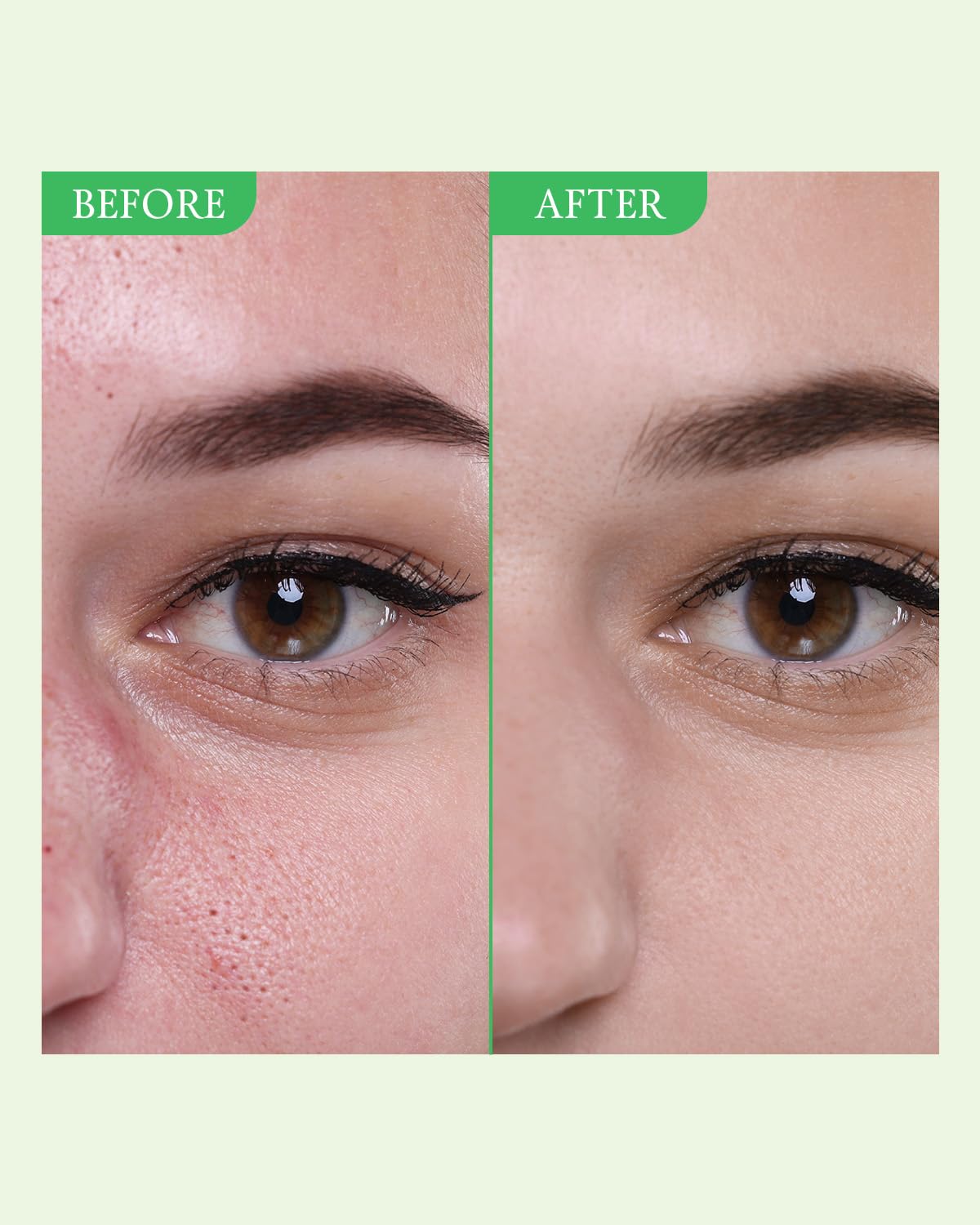 Foto 3 | Mascarilla Limpiadora De Arcilla, Totalmente Verde, Purificadora De Poros De Tomate, 120 Ml - Venta Internacional.