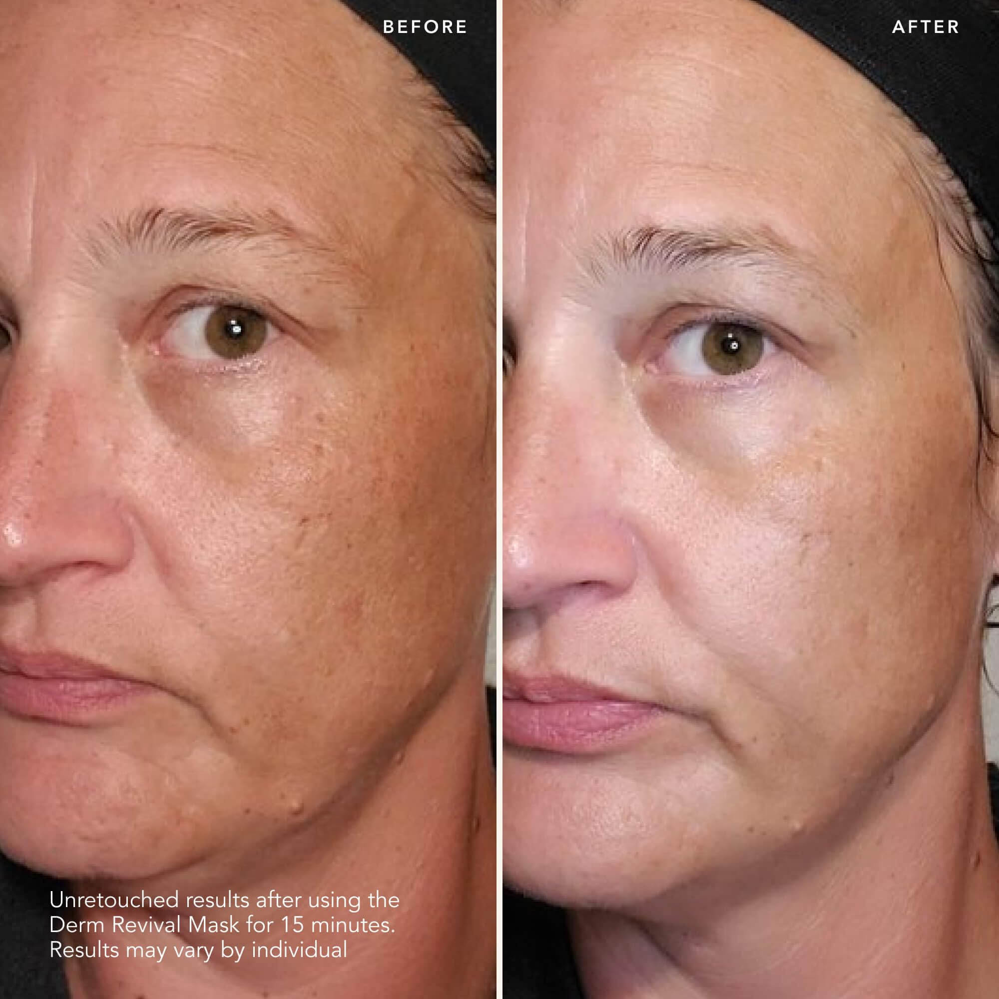 Foto 3 pulgar | Mascarilla Facial Sk-ii Brightening Derm Revival Con Pitera, 10 Unidades - Venta Internacional.