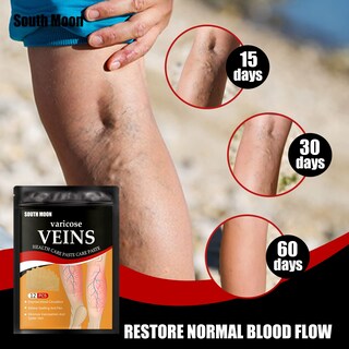 Foto 2 | Tratamiento con Parches Para Venas Varicosas Veinhealth - Venta Internacional