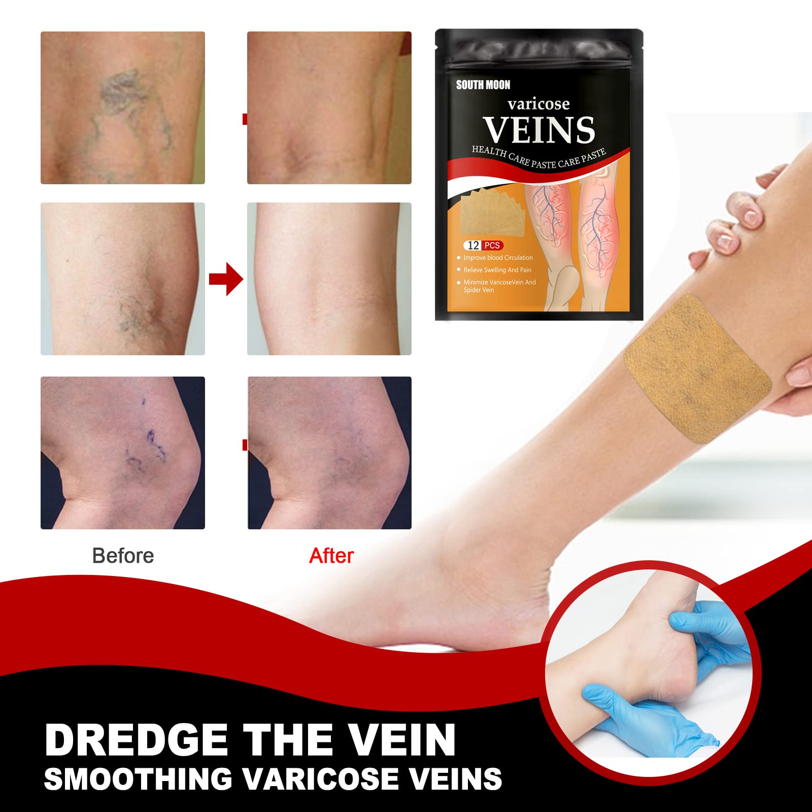 Foto 4 pulgar | Tratamiento con Parches Para Venas Varicosas Veinhealth  - Venta Internacional