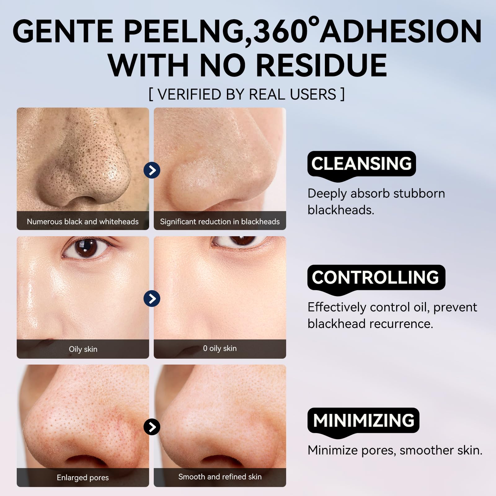 Foto 8 pulgar | Set Para Eliminar Puntos Negros Lanbena Pore Strips, 30 G, Sérum, 30 Ml - Venta Internacional.
