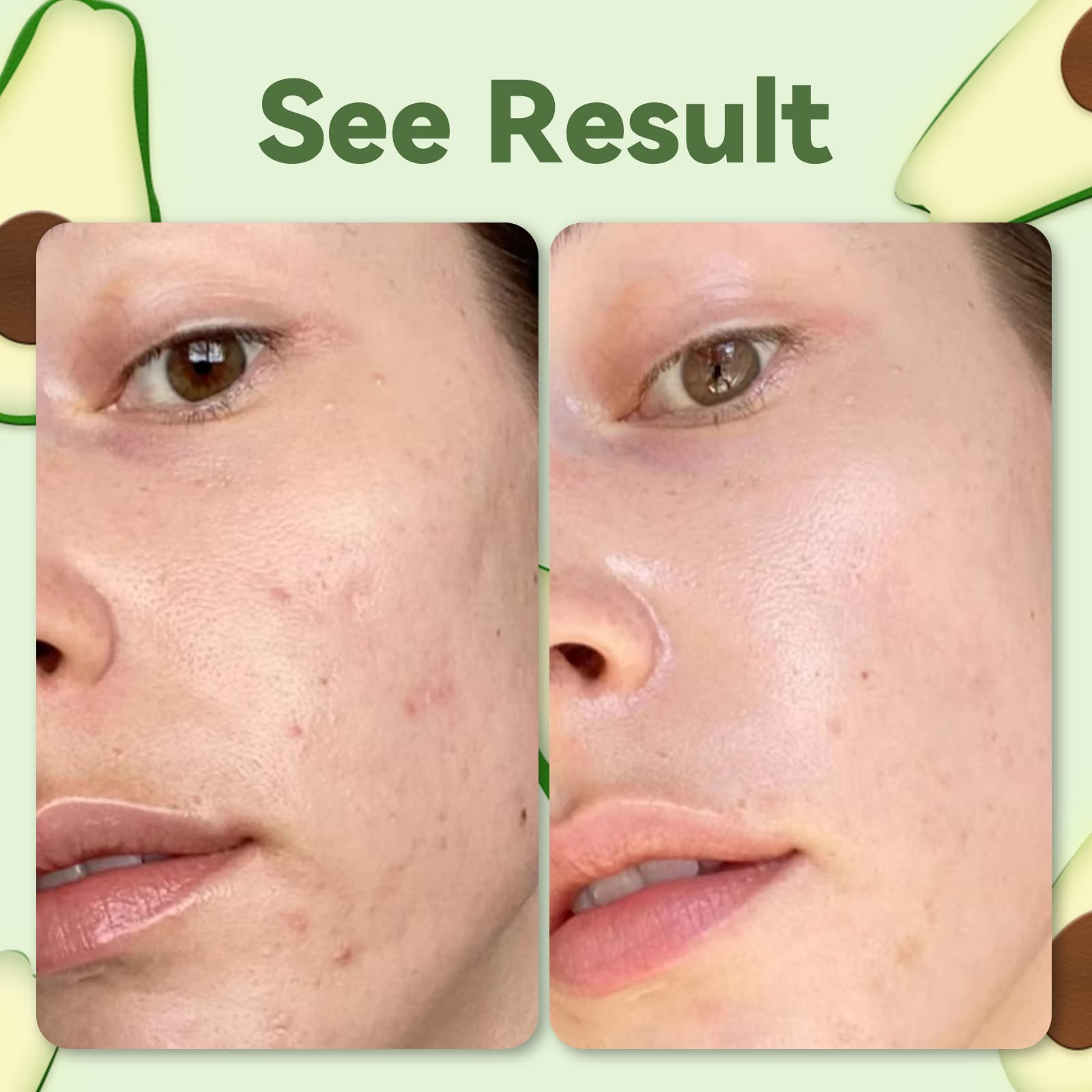 Foto 7 pulgar | Mascarilla Facial Anai Rui Green Tea Con Arcilla De Aguacate 120 G/120 Ml - Venta Internacional.