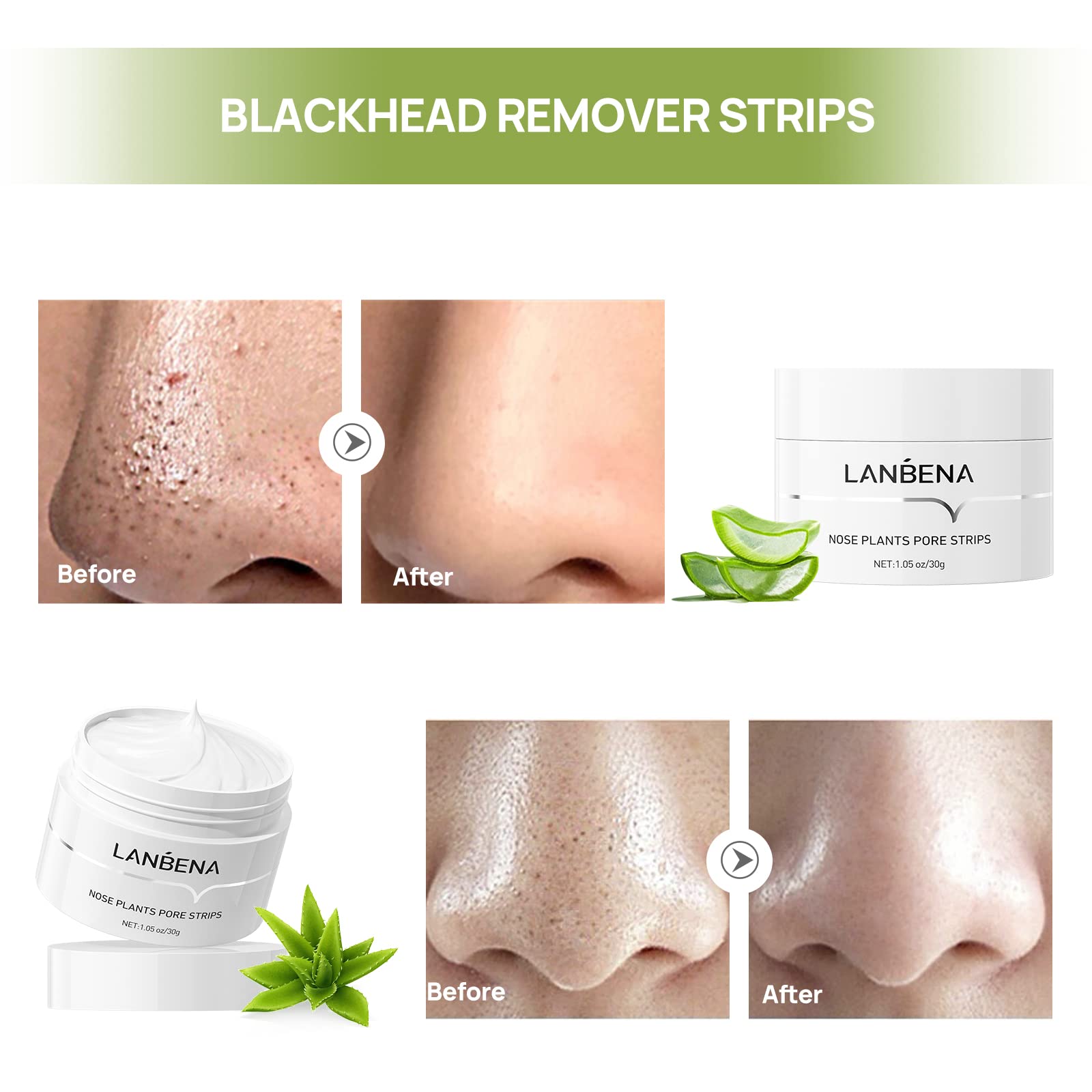 Foto 3 pulgar | Mascarilla Removedora de Puntos Negros Lanbena para Nariz y Rostro 30 ml - Venta Internacional
