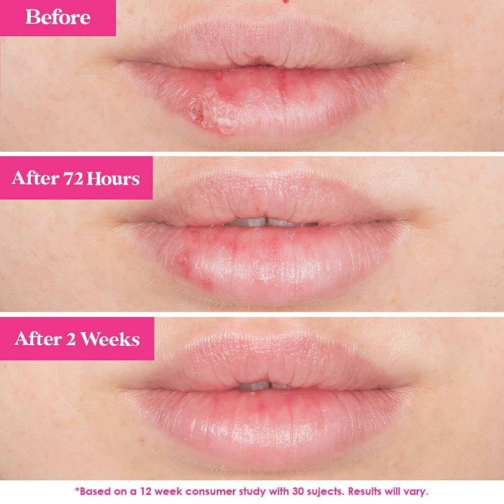 Foto 6 pulgar | Mascarilla De Labios Grande Cosmetics Grandepout Plumping Berry Mojito - Venta Internacional.