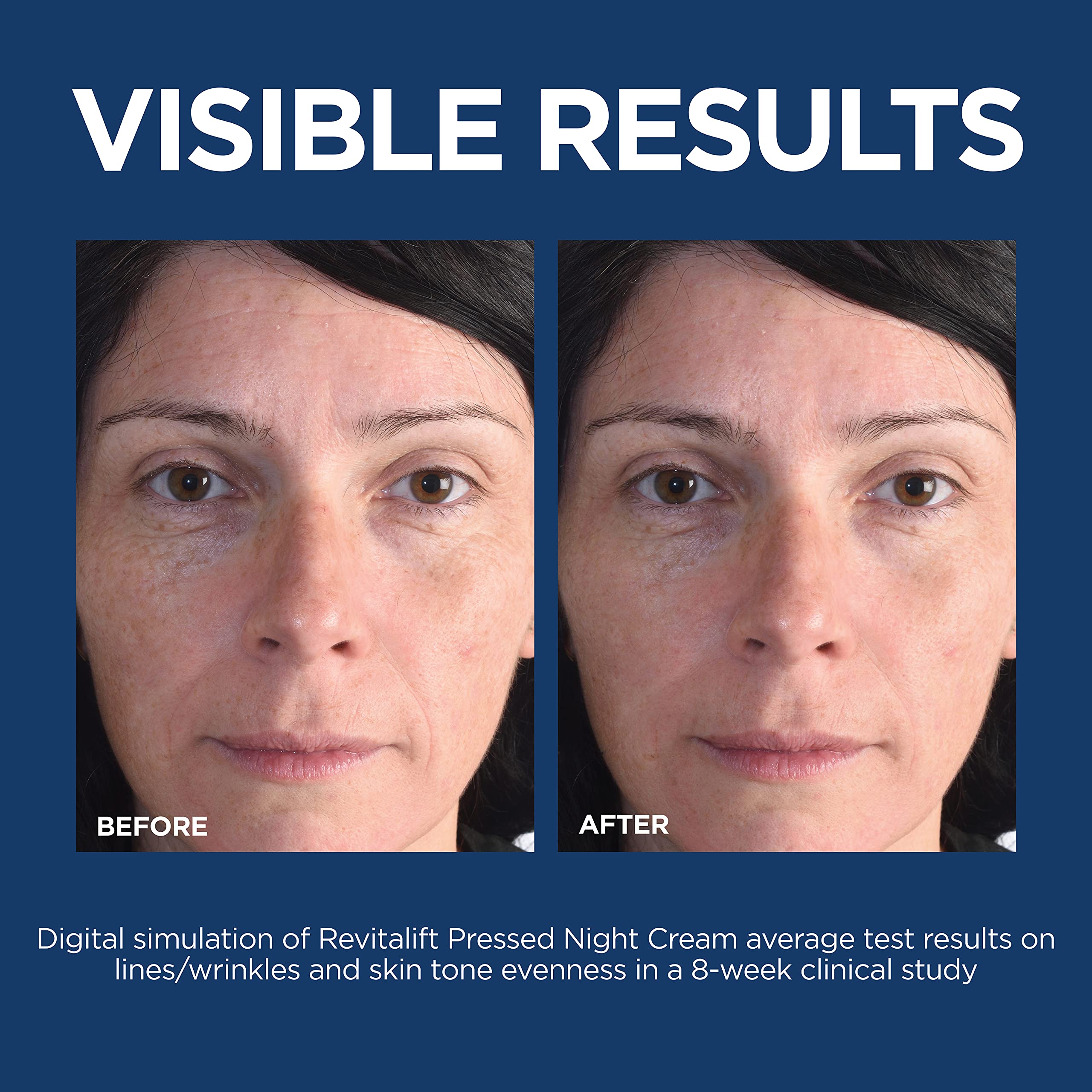 Foto 8 pulgar | Crema De Noche L'oreal Paris Revitalift Retinol + Niacinamida 50 Ml - Venta Internacional.