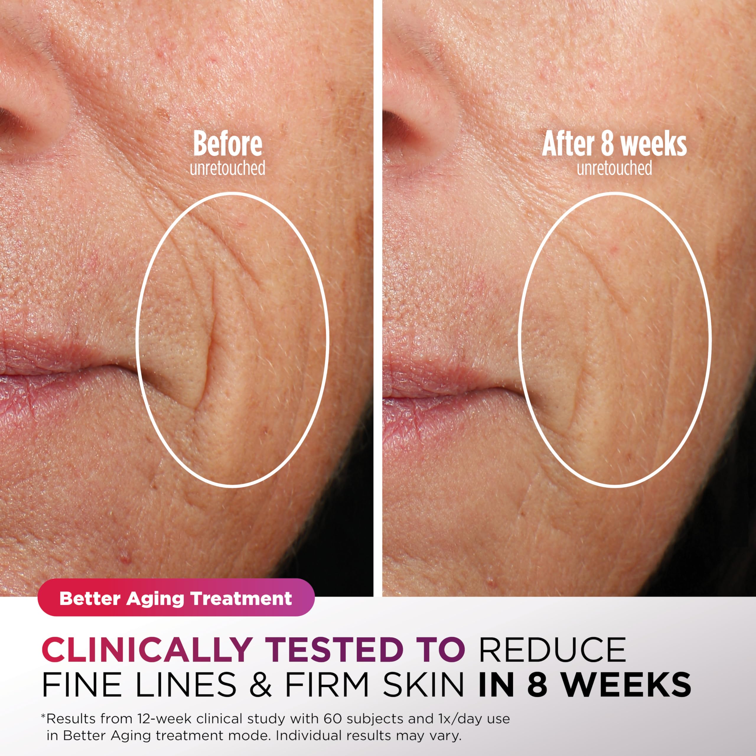 Foto 5 | Mascarilla Facial Led Shark Cryoglow Con Color Lila Refrescante Para Debajo De Los Ojos - Venta Internacional.