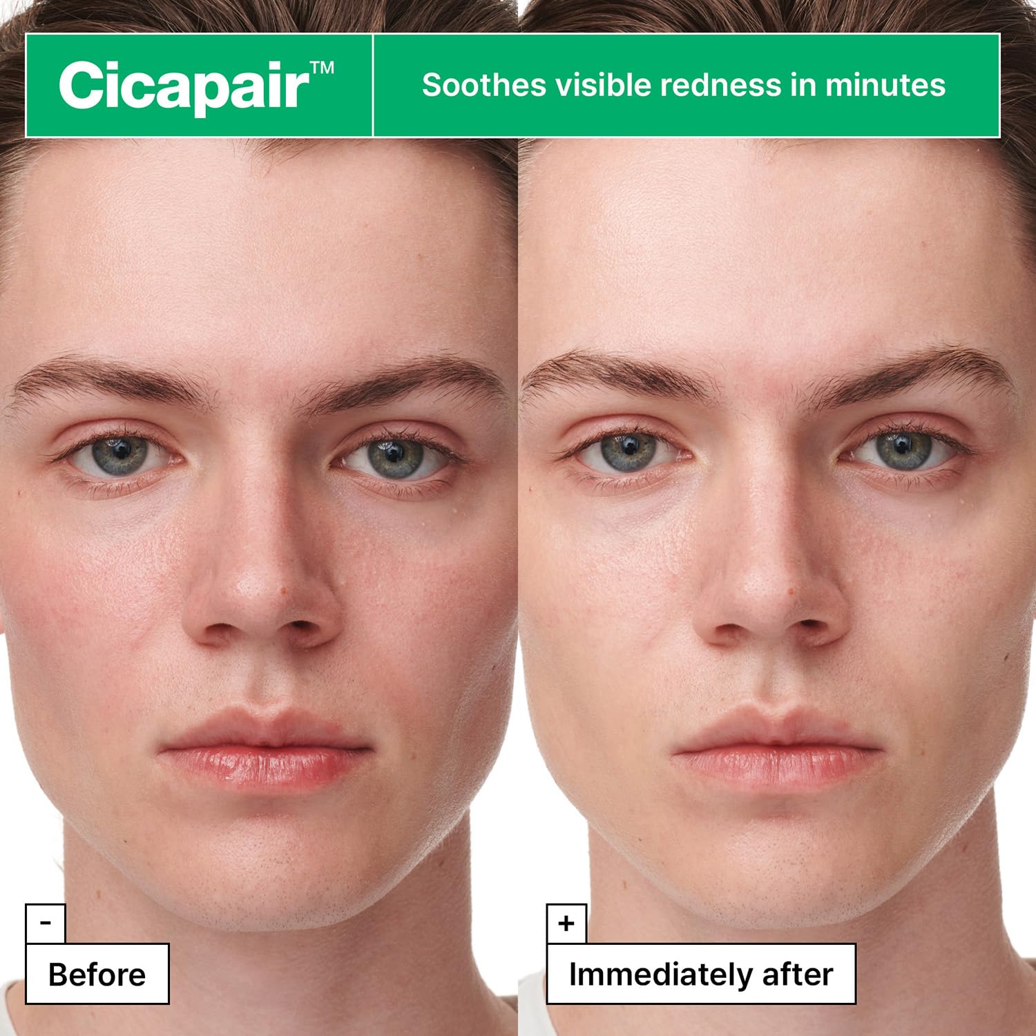 Foto 4 pulgar | Sheet Mask Dr.jart+ Cicapair™ Sérum Para Piel Sensible, Paquete De 5 - Venta Internacional.