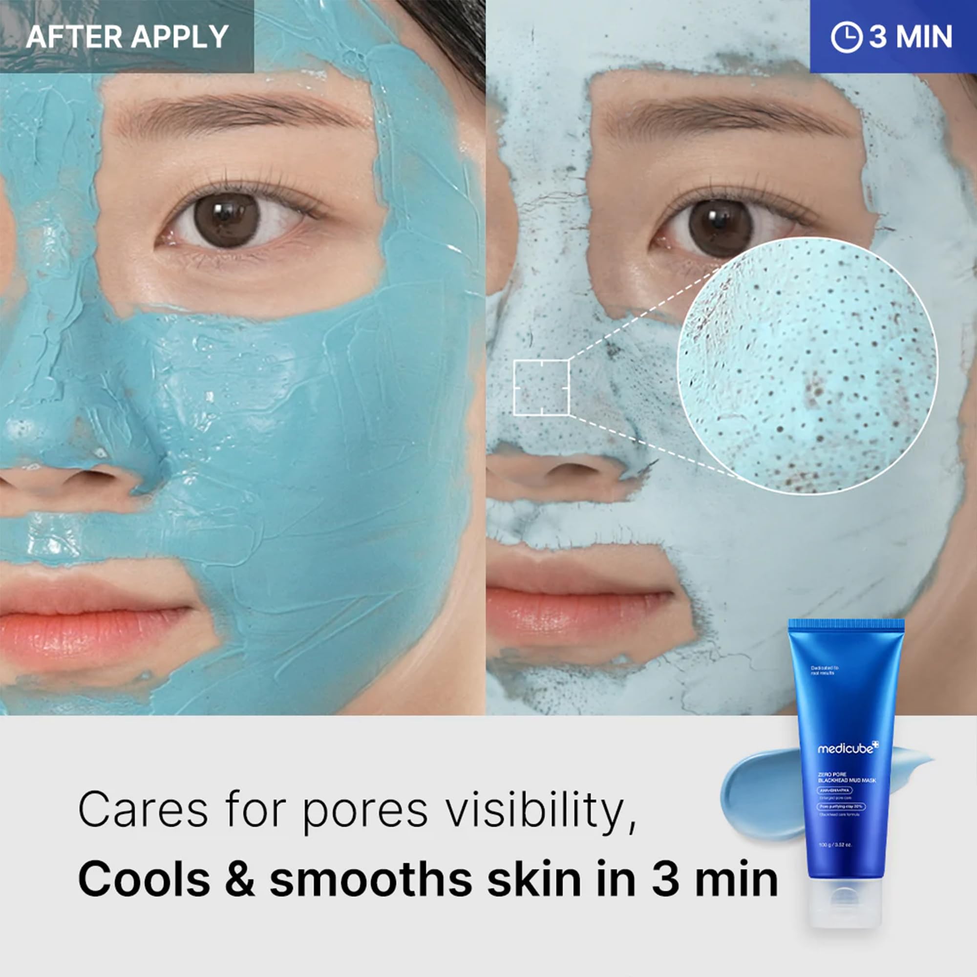 Foto 5 pulgar | Mascarilla Facial Medicube Zero Pore Blackhead Mud 100 Ml - Venta Internacional.