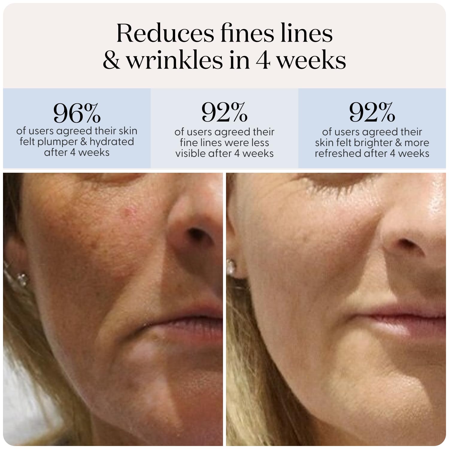 Foto 8 pulgar | Mascarilla Facial De Terapia Con Luz Roja Led Smoothskin Duolux Con 15 Mascarillas - Venta Internacional.