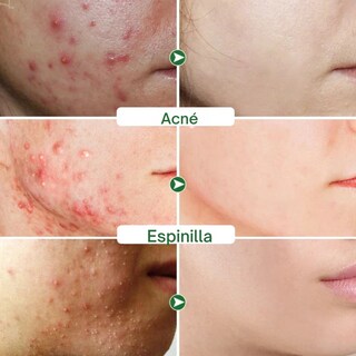 Foto 3 | Set 5 Mascarilla Negra Facial Bambu Elimina Puntos Negros Nariz
