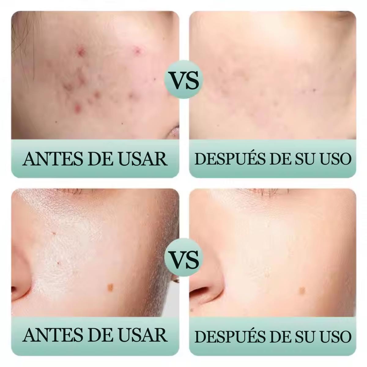 Foto 5 pulgar | Set 5 Mascarilla Negra Facial Bambu Elimina Puntos Negros Nariz