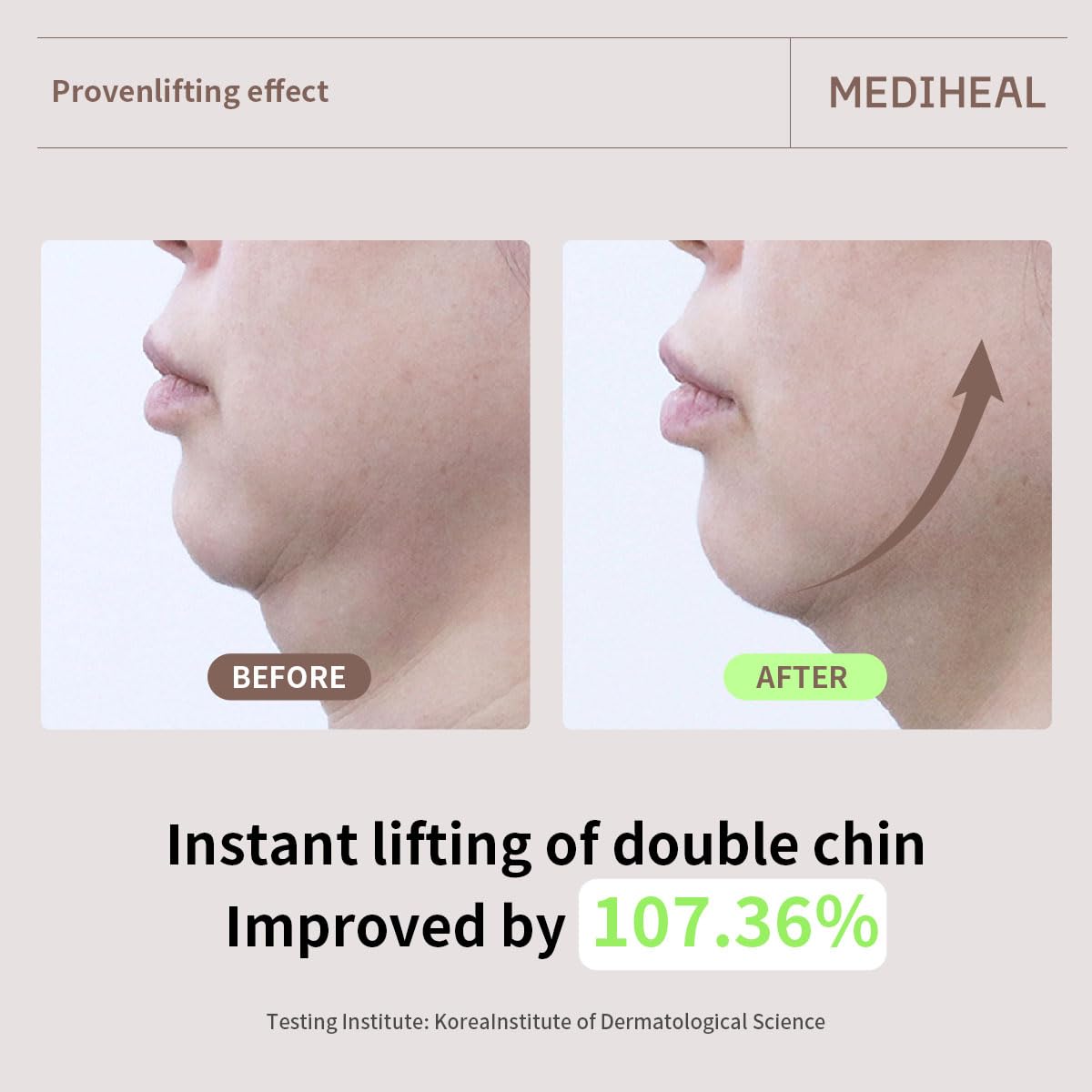 Foto 7 pulgar | Mascarilla Mediheal, Crema De Colágeno Con Retinol, Lifting Y Antienvejecimiento - Venta Internacional.