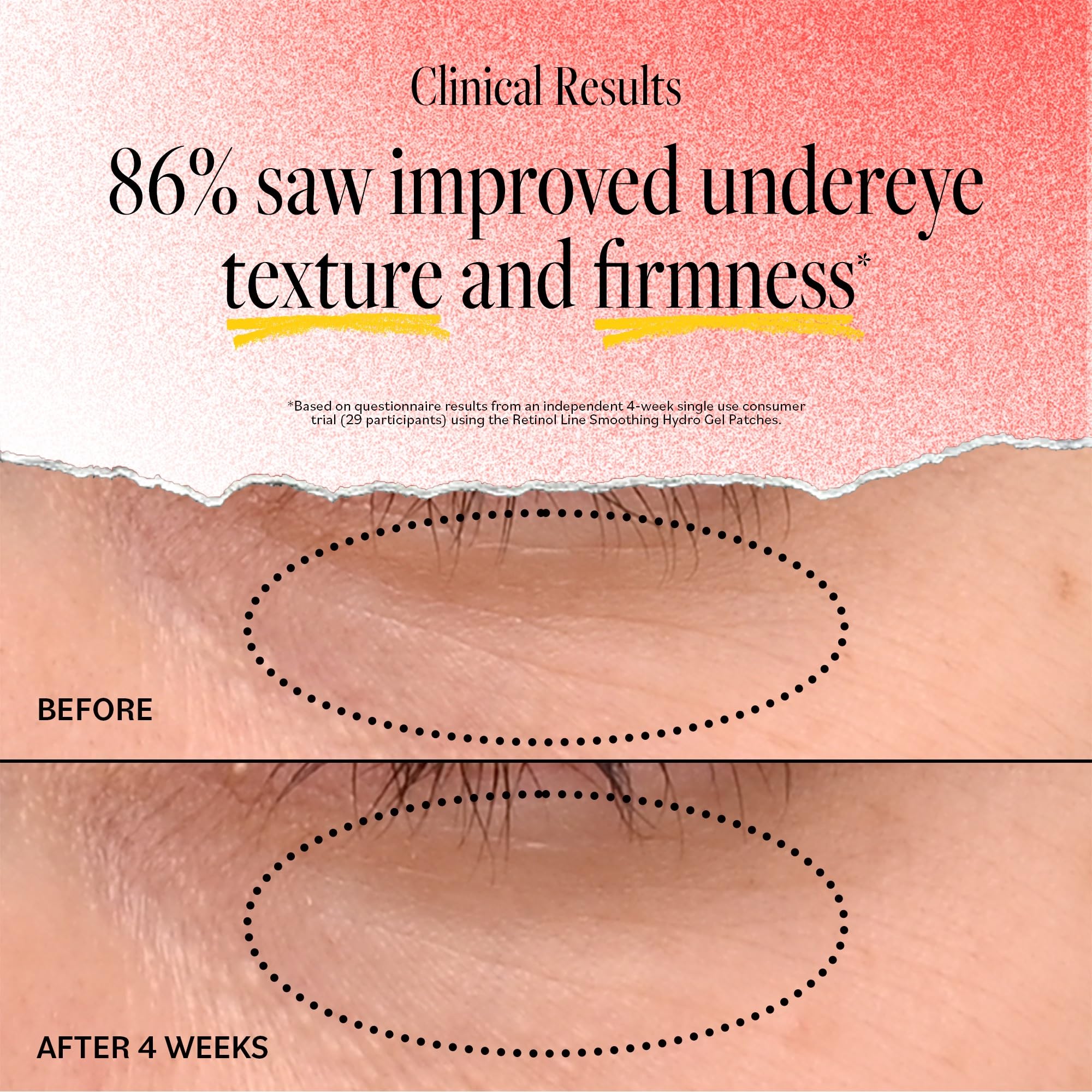 Foto 5 pulgar | Parches Para Debajo De Los Ojos Derma E Retinol Y Bakuchiol, 5 Pares - Venta Internacional.