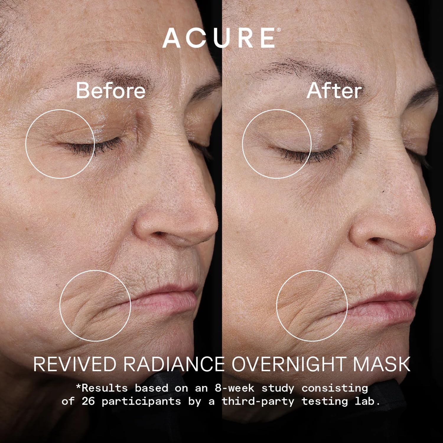 Foto 4 pulgar | Mascarilla Nocturna Acure Revived Radiance 50 Ml Para Líneas Finas - Venta Internacional.