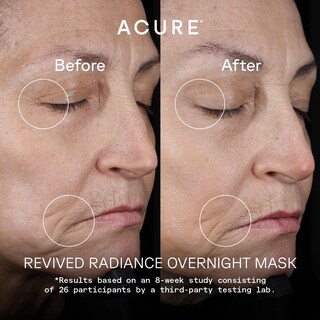 Foto 3 | Mascarilla Nocturna Acure Revived Radiance 50 Ml Para Líneas Finas - Venta Internacional.