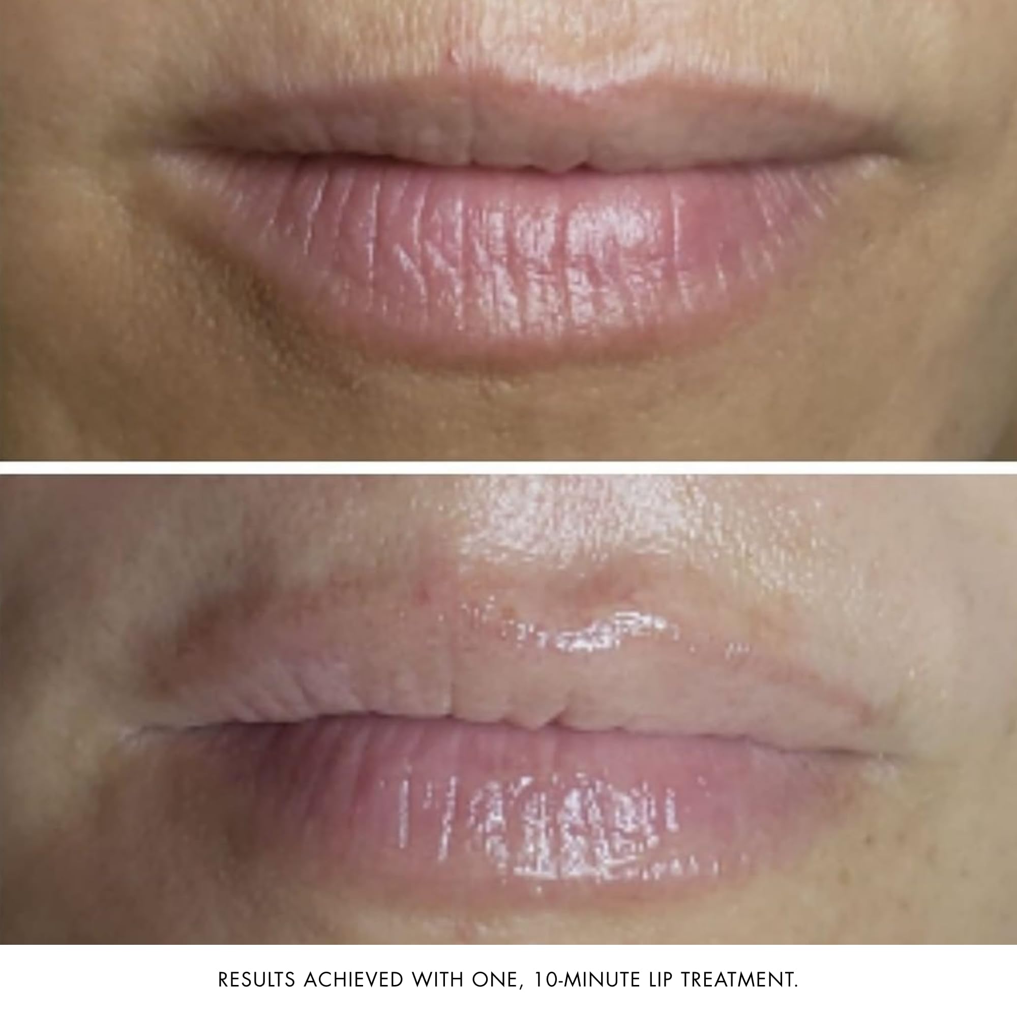 Foto 7 pulgar | Mascarilla Facial Y Labial Bioelements Collagen Rehab 50 Ml Vegan - Venta Internacional.