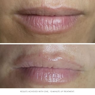 Foto 6 | Mascarilla Facial Y Labial Bioelements Collagen Rehab 50 Ml Vegan - Venta Internacional.