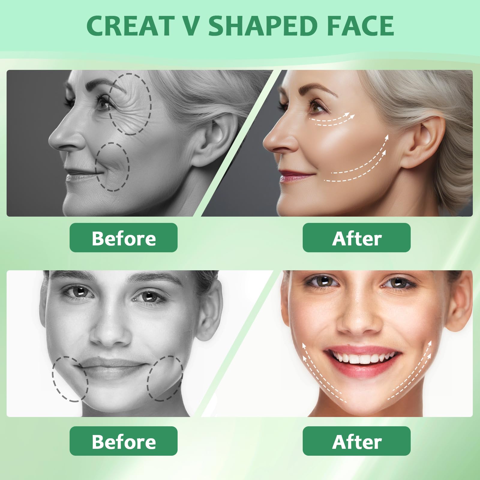 Foto 3 | Cinta De Estiramiento Facial Nbf  160 Unidades  Invisible  Impermeable  Con Cuerda - Venta Internacional.