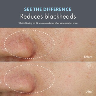 Foto 6 | Mascarilla Y Exfoliante Origins Clear Improvement 75 Ml Con Ácido Salicílico Y Carbón De Bambú - Venta Internacional.