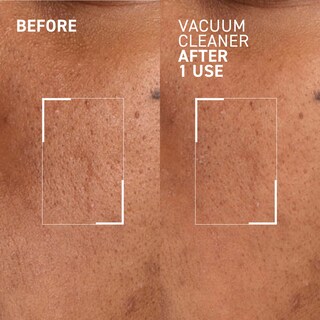 Foto 3 | Máscara Purificadora De Poros Dr. Brandt Pores No More Aspiradora - Venta Internacional.