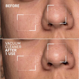 Foto 4 | Máscara Purificadora De Poros Dr. Brandt Pores No More Aspiradora - Venta Internacional.