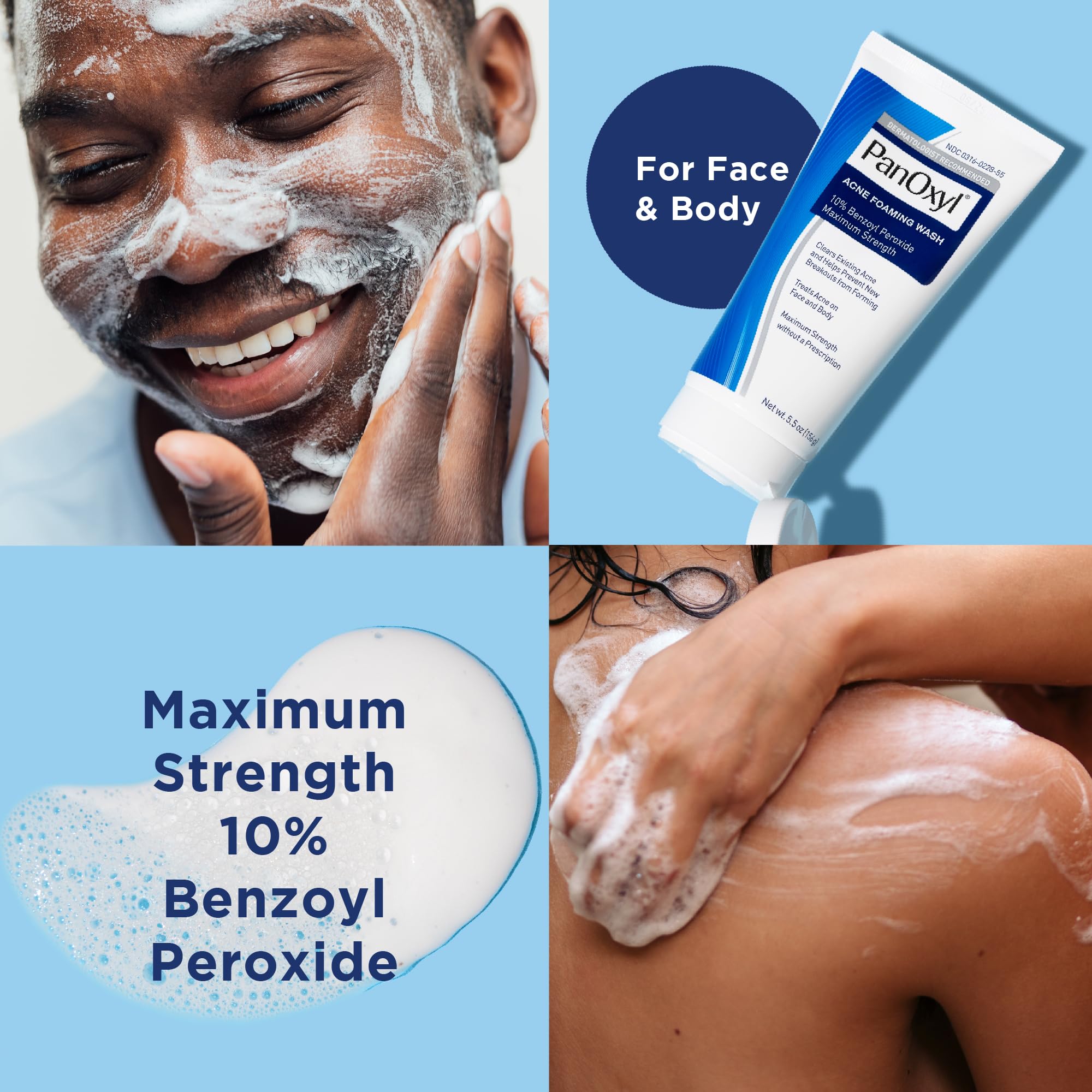 Foto 4 | Jabón Facial Panoxyl, Jabón Espumoso Para El Acné, Peróxido De Benzoilo Al 10%, 165 Ml - Venta Internacional.