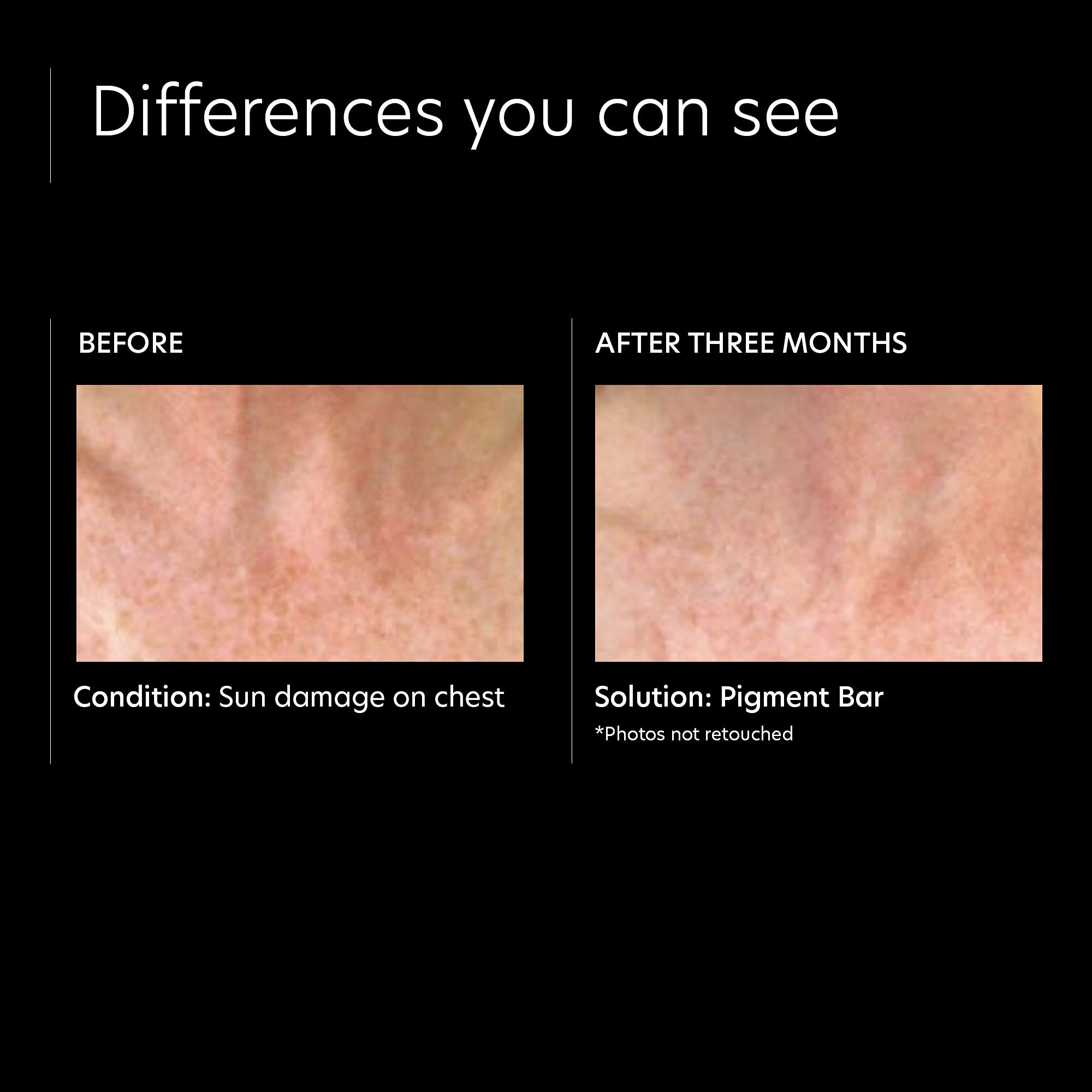 Foto 5 pulgar | Jabón Limpiador Pca Skin Pigment Bar Face & Body 90 ml - Venta Internacional