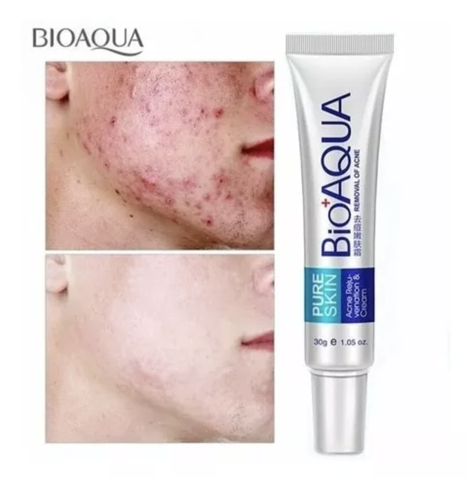 Foto 4 pulgar | Crema Anti Acne Bioaqua Pure Skin Cicatrices Control Grasa