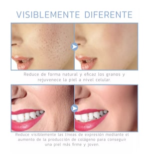Foto 4 | Dispositivo de Belleza de Alta Frecuencia para el Rostro Dorado y Blanco