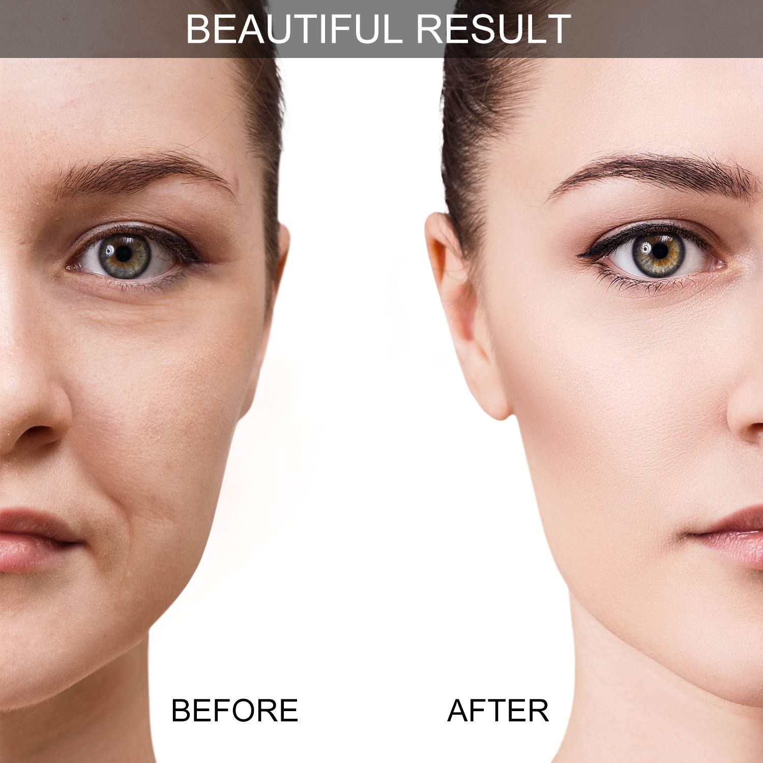 Foto 4 | Set De Ventosas Faciales Bbto Para Masaje Facial Y Ocular - Venta Internacional.