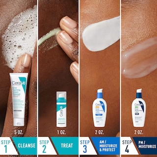 Foto 2 | Set Para El Cuidado De La Piel Cerave Acne Con Crema Limpiadora Espumosa Para El Acné De 150 Ml - Venta Internacional.