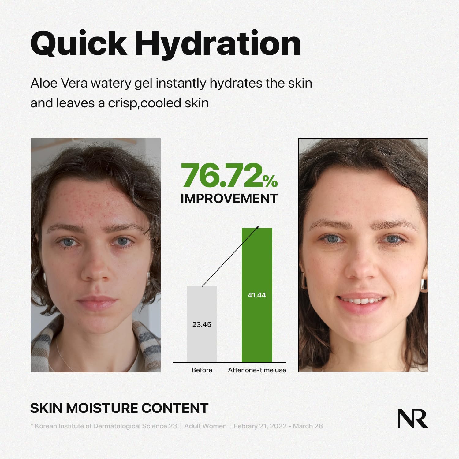Foto 5 | Gel Calmante Nature Republic, Suave E Hidratante Con Aloe Vera Acuoso - Venta Internacional.