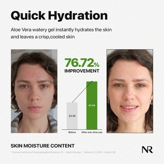 Foto 5 | Gel Calmante Nature Republic, Suave E Hidratante Con Aloe Vera Acuoso - Venta Internacional.