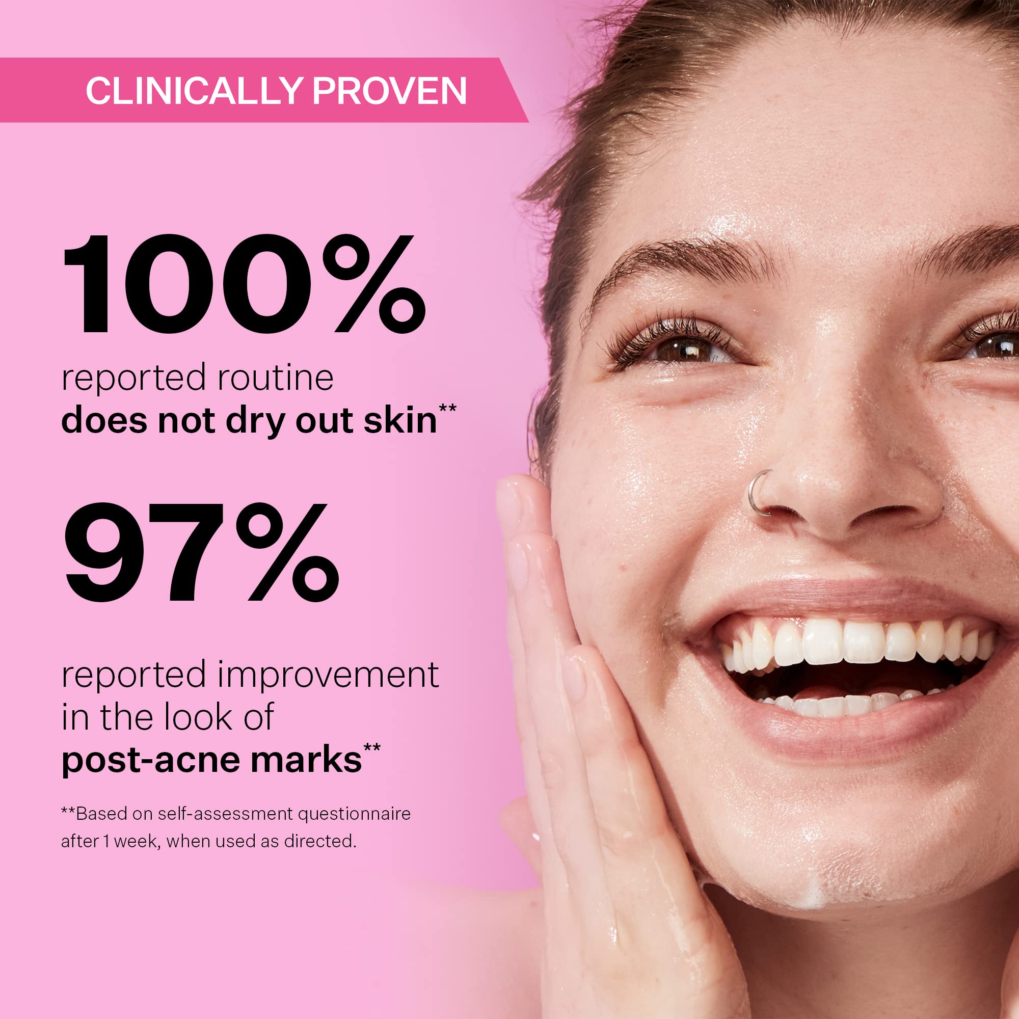 Foto 4 | Set de Control Tratamiento Acné Strivectin Multi-action Clear 30 Day - Venta Internacional