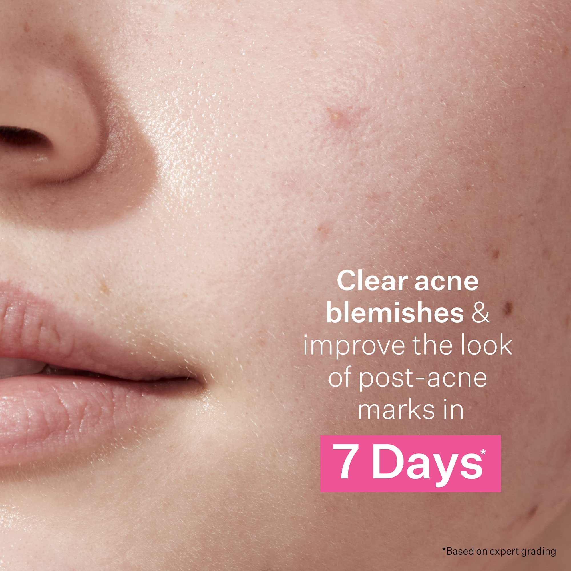 Foto 5 | Set de Control Tratamiento Acné Strivectin Multi-action Clear 30 Day - Venta Internacional