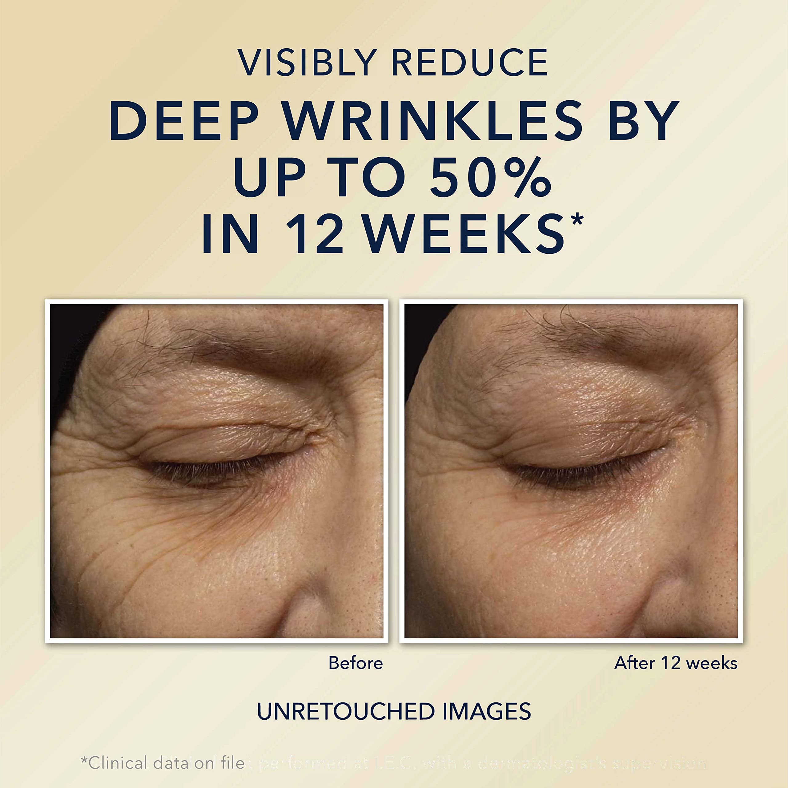Foto 4 | Crema De Noche Roc Retinol Correxion Deep Arrugas Antiedad 30 Ml - Venta Internacional.
