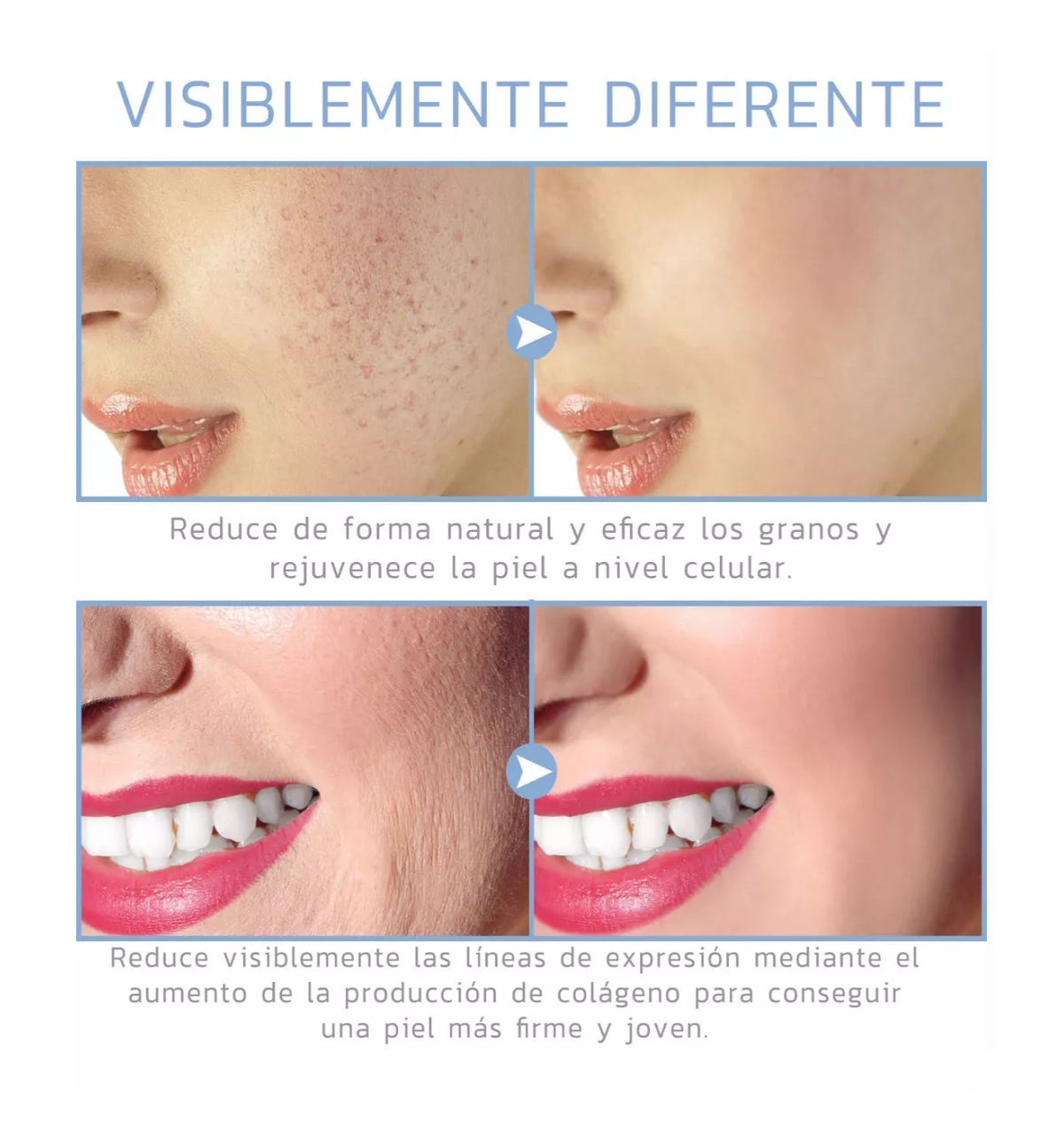 Foto 4 | Dispositivo De Belleza Lab.g De Alta Frecuencia Para El Rostro Dorado/blanco