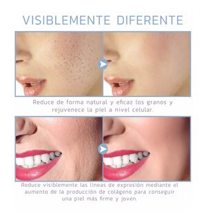 Foto 4 | Dispositivo De Belleza Lab.g De Alta Frecuencia Para El Rostro Dorado/blanco