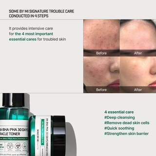 Foto 5 | Set De Cuidado De La Piel Some By Mi Aha Bha Pha, Kit De Inicio De 30 Días - Venta Internacional.